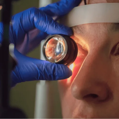 Manejo de glaucoma en Tlaxiaco, Oaxaca: evaluación, tratamiento y seguimiento